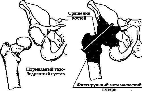 Евдокименко. Артроз. Избавляемся от боли в суставах